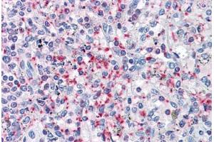 Human Spleen: Formalin-Fixed, Paraffin-Embedded (FFPE)