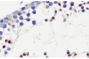 Immunohistochemistry of paraffin-embedded Mouse testis using HFM1 Polyclonal Antibody at dilution of 1:100 (40x lens). (HFM1 anticorps)