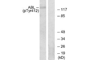 Immunohistochemistry analysis of paraffin-embedded human brain tissue using Abl (Phospho-Tyr393/412) antibody. (ABL1 anticorps  (pTyr393, pTyr412))