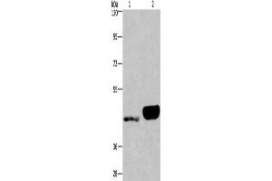 Gel: 6 % SDS-PAGE, Lysate: 40 μg, Lane 1-2: Human endometrial cancer tissue, Human placenta tissue, Primary antibody: ABIN7190562(ENPP4 Antibody) at dilution 1/200, Secondary antibody: Goat anti rabbit IgG at 1/8000 dilution, Exposure time: 40 seconds (ENPP4 anticorps)
