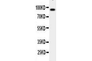 Anti-GCSF Receptor antibody, Western blotting WB: Human Placenta Tissue Lysate (CSF3R anticorps  (Middle Region))