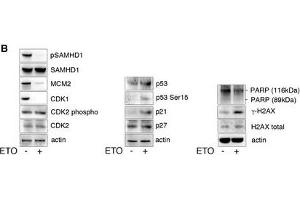 ETO regulates SAMHD1 phosphorylation through the p53, p21 pathwayMDM were treated with increasing concentrations of ETO and CTH. (p53 anticorps  (N-Term))