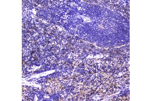 IHC analysis of NCR1 using anti-NCR1 antibody .