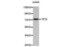 Western Blotting (WB) image for anti-Tumor Protein P73 (TP73) antibody (ABIN1875173)