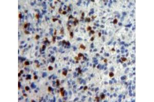 Used in DAB staining on fromalin fixed paraffin-embedded Spleen tissue