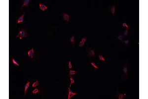 ABIN6268837 staining U-251 MG cells by IF/ICC. (Galectin 9 anticorps  (Internal Region))