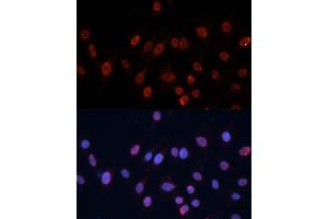 Immunofluorescence analysis of C6 cells using hnRNP U antibody (ABIN1680323, ABIN3018279, ABIN3018280 and ABIN6220424) at dilution of 1:100.