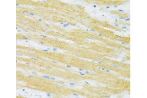 Immunohistochemistry of paraffin-embedded Rat heart using TYROBP Polyclonal Antibody at dilution of 1:100 (40x lens). (TYROBP anticorps)