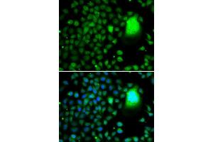 Immunofluorescence analysis of A-549 cells using TAF5 antibody. (TAF5 anticorps  (AA 656-800))