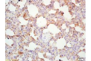 Formalin-fixed and paraffin embedded mouse lung labeled with Rabbit Anti Integrin alpha 4/CD49d/Integrin ?
