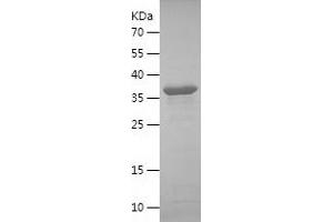 Western Blotting (WB) image for Immune Receptor Expressed On Myeloid Cells 1 (IREM1) (AA 21-151) protein (His-IF2DI Tag) (ABIN7123404)
