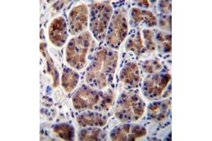 Immunohistochemistry analysis in formalin fixed and paraffin embedded human stomach tissue reacted with MAN2A2 Antibody (Center) followed which was peroxidase conjugated to the secondary antibody and followed by DAB staining.