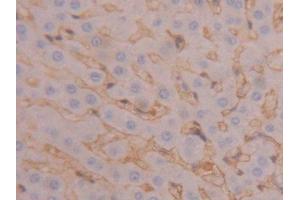 IHC-P analysis of Rat Liver Tissue, with DAB staining. (Fibrinogen beta Chain anticorps  (AA 33-479))