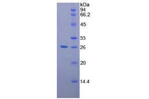 SDS-PAGE analysis of Human Pepsinogen A Protein.
