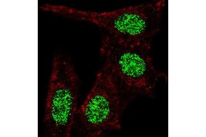 Fluorescent confocal image of HeLa cells stained with f KLF4  antibody.