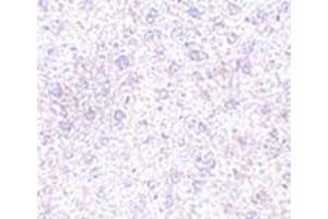anti-Plexin Domain Containing 1 (PLXDC1) (C-Term) antibody