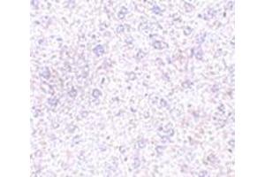 Immunohistochemistry of TEM7 in mouse liver tissue with this product at 2. (PLXDC1 anticorps  (C-Term))