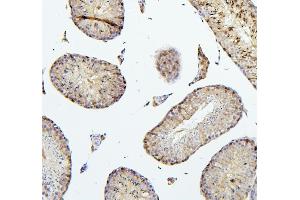 IHC analysis of TEK using anti-TEK antibody (ABIN7600762). (TEK anticorps  (AA 23-616))
