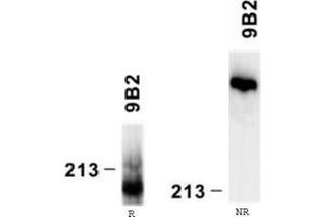 Western Blotting (WB) image for anti-Laminin, alpha 4 (LAMa4) antibody (ABIN781771) (LAMa4 anticorps)