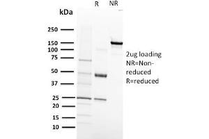 SDS-PAGE Analysis Purified VEGF-R1 Mouse Monoclonal Antibody (FLT1/658). (FLT1 anticorps)