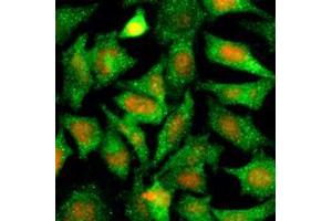 Immunofluorescence (IF) image for anti-serpin Peptidase Inhibitor, Clade B (Ovalbumin), Member 5 (SERPINB5) (AA 1-375), (N-Term) antibody (ABIN452658)