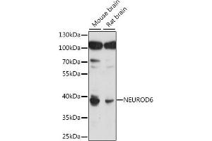 Western blot analysis of extracts of various cell lines, using NEUROD6 antibody (ABIN7268868) at 1:1000 dilution. (NEUROD6 anticorps  (AA 188-337))
