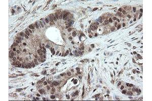 Image no. 2 for anti-Pyridoxamine 5'-Phosphate Oxidase (PNPO) antibody (ABIN1500318)