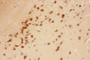 Anti-BDNF Picoband antibody,  IHC(P): Rat Brain Tissue (BDNF anticorps  (AA 129-247))