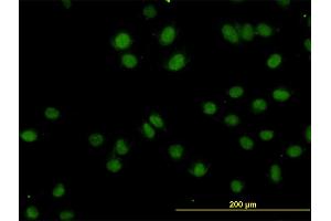 Immunofluorescence of monoclonal antibody to TOPORS on HeLa cell.