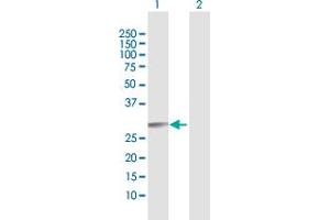 Western Blot analysis of RAB27B expression in transfected 293T cell line by RAB27B MaxPab polyclonal antibody.
