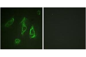 Immunofluorescence analysis of HeLa cells, using Epo-R (Ab-368) Antibody. (EPOR anticorps  (AA 341-390))