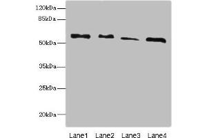 Western blot All lanes: RTKN antibody at 4. (Rhotekin anticorps  (AA 304-563))