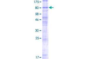 Image no. 1 for Solute Carrier Family 17 (Vesicular Glutamate Transporter), Member 7 (SLC17A7) (AA 1-560) protein (GST tag) (ABIN1320157)