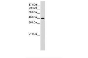 Image no. 2 for anti-Transcription Factor AP-2 gamma (Activating Enhancer Binding Protein 2 Gamma) (TFAP2C) (N-Term) antibody (ABIN203339)