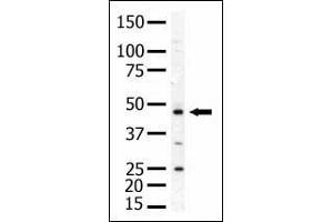 The anti-PIP4K2A Pab (ABIN392597 and ABIN2842126) is used in Western blot to detect PIP4K2A in mouse skeletal muscle tissue lysate.