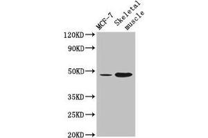 Western Blot Positive WB detected in: MCF-7 whole cell lysate, Mouse skeletal muscle tissue All lanes: ARRDC3 antibody at 4 μg/mL Secondary Goat polyclonal to rabbit IgG at 1/50000 dilution Predicted band size: 47 kDa Observed band size: 47 kDa (ARRDC3 anticorps  (AA 1-270))