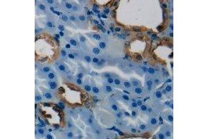 Immunohistochemical analysis of HSD3B7 staining in human kidney formalin fixed paraffin embedded tissue section. (HSD3B7 anticorps)