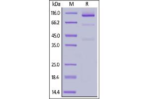 Cynomolgus Glypican 3, Llama IgG2b Fc Tag, low endotoxin on  under reducing (R) condition.