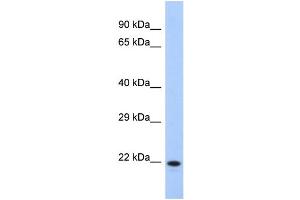 Western Blotting (WB) image for anti-Coiled-Coil Domain Containing 27 (CCDC27) (N-Term) antibody (ABIN2785189) (CCDC27 anticorps  (N-Term))