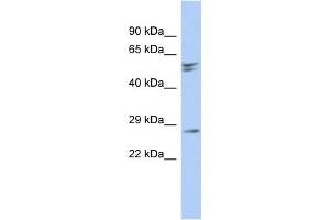 RD3 antibody used at 1 ug/ml to detect target protein. (RD3 anticorps  (N-Term))