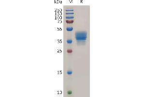 Chemokine (C-C Motif) Receptor 3 (CCR3) (AA 1-34) protein (Fc Tag)