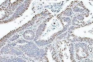IHC analysis of CTBP2 using anti-CTBP2 antibody (ABIN7601325). (CTBP2 anticorps  (AA 321-445))