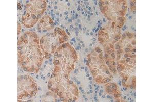 Used in DAB staining on fromalin fixed paraffin- embedded kidney tissue (HEXB anticorps  (AA 100-216))