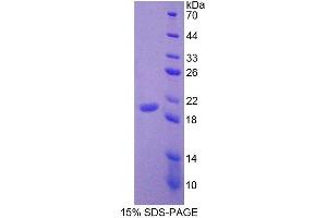 Image no. 1 for Leukocyte Cell-Derived Chemotaxin 2 (LECT2) (AA 1-151) protein (His tag) (ABIN4990433) (LECT2 Protein (AA 1-151) (His tag))