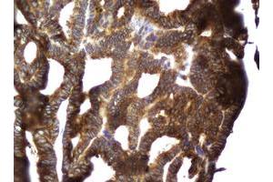 Image no. 3 for anti-Coiled-Coil Domain Containing 93 (CCDC93) (AA 293-631) antibody (ABIN1491348)