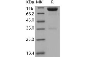 Western Blotting (WB) image for AXL Receptor tyrosine Kinase (AXL) protein (His tag,Fc Tag) (ABIN7320398)
