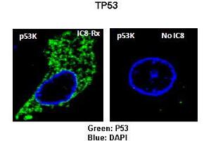 Sample Type: Rat thyrocytes-FRTL-5  Primary Antibody Dilution: 1:100 Secondary Antibody: Anti-rabbit-FITC  Secondary Antibody Dilution: 1:000 Color/Signal Descriptions: Green: TP53RKBlue: DAPI  Gene Name: TP53RK Submitted by: Syed A Morshed, Mount Sinai School of Medicine and James J Peters VA Medical Center (TP53RK anticorps  (N-Term))