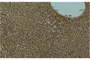 Immunohistochemistry of paraffin-embedded Rat liver tissue using PI 3 kinase p85 alpha Monoclonal Antibody at dilution of 1:200. (PIK3R1 anticorps)