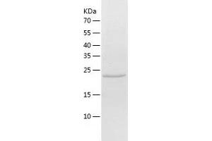 Western Blotting (WB) image for Ubiquitin Specific Peptidase 12 (USP12) (AA 165-370) protein (His-IF2DI Tag) (ABIN7125587)
