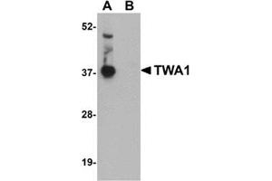 Western blot analysis of TWA1 in human brain tissue lysate with this product at 1 μg/ml in (A) the absence and (B) the presence of blocking peptide. (TTC5 anticorps  (C-Term))